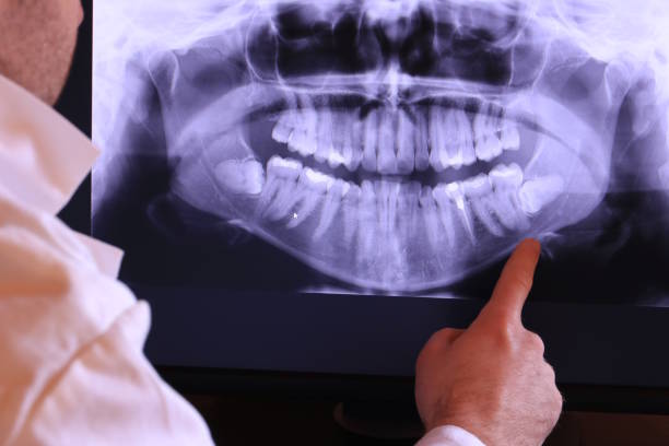 Best Emergency Denture Repair in Silverton, OR